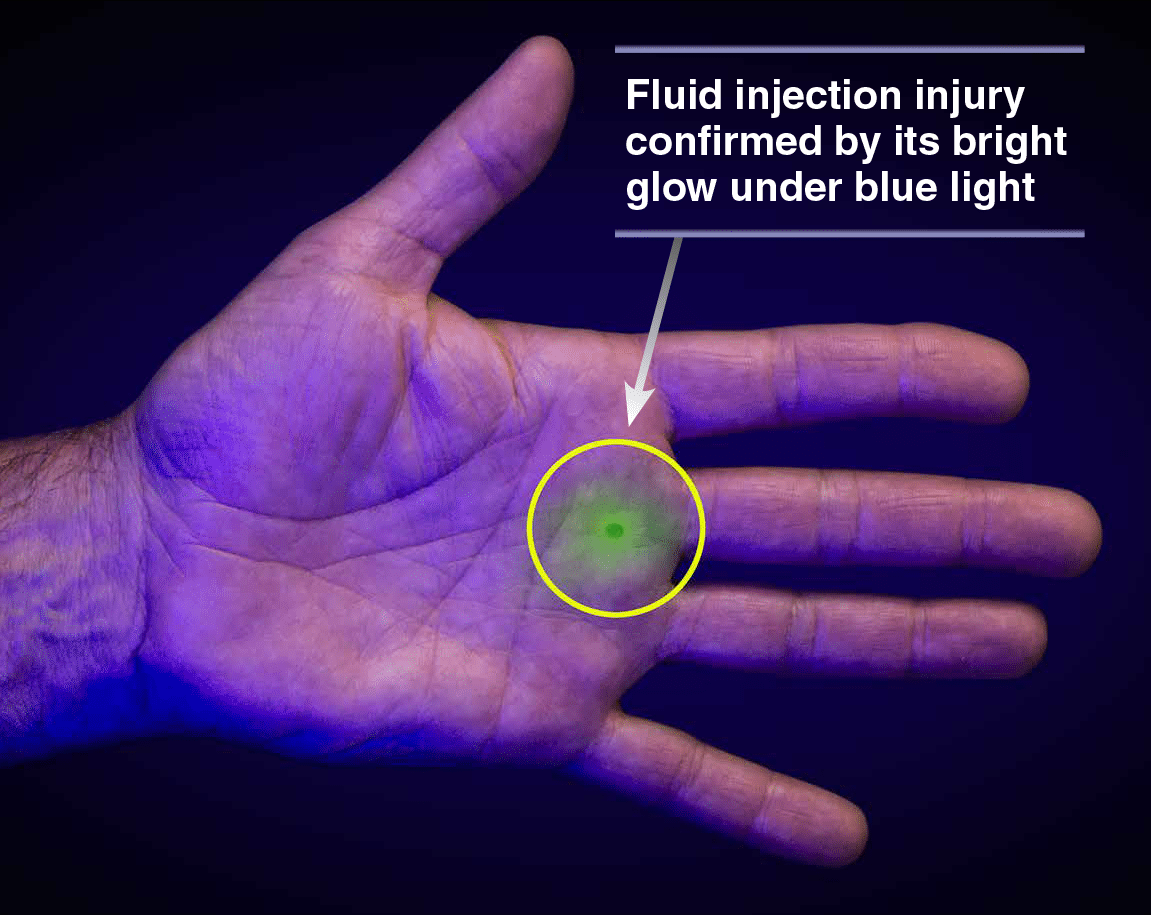 injecting glow stick